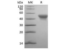 CD84 / SLAMF5 Protein - Recombinant Human SLAM Family Member 5/SLAMF5/CD84(C-6His-Avi) Biotinylated
