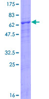 CD84 / SLAMF5 Protein - 12.5% SDS-PAGE of human CD84 stained with Coomassie Blue
