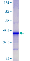 CD84 / SLAMF5 Protein - 12.5% SDS-PAGE Stained with Coomassie Blue.