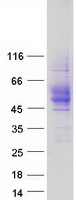 CD84 / SLAMF5 Protein - Purified recombinant protein CD84 was analyzed by SDS-PAGE gel and Coomassie Blue Staining
