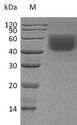 CD86 Protein - (Tris-Glycine gel) Discontinuous SDS-PAGE (reduced) with 5% enrichment gel and 15% separation gel.