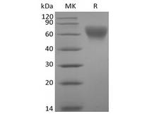 CD86 Protein - Recombinant Human B7-2/CD86 (C-Avi-6His) Biotinylated