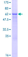 CD86 Protein - 12.5% SDS-PAGE of human CD86 stained with Coomassie Blue