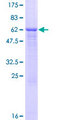 CD86 Protein - 12.5% SDS-PAGE of human CD86 stained with Coomassie Blue