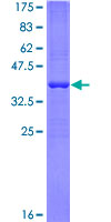 CD86 Protein - 12.5% SDS-PAGE Stained with Coomassie Blue.