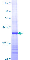 CD8A / CD8 Alpha Protein - 12.5% SDS-PAGE Stained with Coomassie Blue.