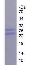 CD8A / CD8 Alpha Protein - Recombinant Cluster Of Differentiation 8a By SDS-PAGE
