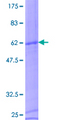 CD8B / CD8 Beta Protein - 12.5% SDS-PAGE of human CD8B1 stained with Coomassie Blue