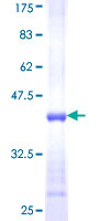 CD8B / CD8 Beta Protein - 12.5% SDS-PAGE Stained with Coomassie Blue.