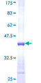 CD8B / CD8 Beta Protein - 12.5% SDS-PAGE Stained with Coomassie Blue.