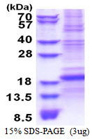 CD8B / CD8 Beta Protein