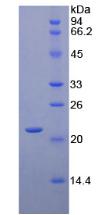 CD8B / CD8 Beta Protein - Recombinant Cluster Of Differentiation 8b By SDS-PAGE