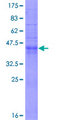 CD9 Protein - 12.5% SDS-PAGE of human CD9 stained with Coomassie Blue
