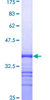 CD9 Protein - 12.5% SDS-PAGE Stained with Coomassie Blue.