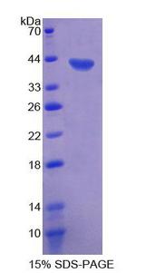 CD9 Protein - Recombinant  Macrophage Inflammatory Protein Related Protein 1 By SDS-PAGE
