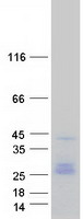 CD9 Protein - Purified recombinant protein CD9 was analyzed by SDS-PAGE gel and Coomassie Blue Staining