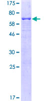 CD95 / FAS Protein - 12.5% SDS-PAGE of human FAS stained with Coomassie Blue