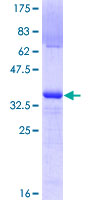CD95 / FAS Protein - 12.5% SDS-PAGE Stained with Coomassie Blue.