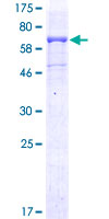 CD96 / TACTILE Protein - 12.5% SDS-PAGE of human CD96 stained with Coomassie Blue