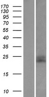 CD99 Protein - Western validation with an anti-DDK antibody * L: Control HEK293 lysate R: Over-expression lysate