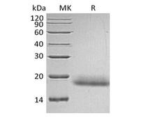CD99 Protein - Recombinant Human CD99/MIC2 (C-6His)