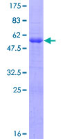 CD99 Protein - 12.5% SDS-PAGE of human CD99 stained with Coomassie Blue