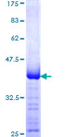 CD99 Protein - 12.5% SDS-PAGE Stained with Coomassie Blue
