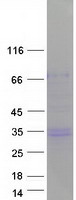 CD99 Protein - Purified recombinant protein CD99 was analyzed by SDS-PAGE gel and Coomassie Blue Staining
