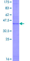 CD99L2 Protein - 12.5% SDS-PAGE of human CD99L2 stained with Coomassie Blue