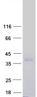 CD99L2 Protein - Purified recombinant protein CD99L2 was analyzed by SDS-PAGE gel and Coomassie Blue Staining