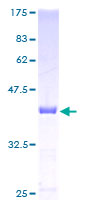 CDA / Cytidine Deaminase Protein - 12.5% SDS-PAGE of human CDA stained with Coomassie Blue