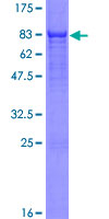 CDADC1 Protein - 12.5% SDS-PAGE of human CDADC1 stained with Coomassie Blue