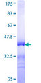 CDADC1 Protein - 12.5% SDS-PAGE Stained with Coomassie Blue.