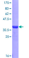 CDAN1 Protein - 12.5% SDS-PAGE Stained with Coomassie Blue.