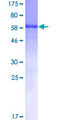 CDC123 Protein - 12.5% SDS-PAGE of human C10orf7 stained with Coomassie Blue