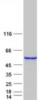 CDC123 Protein - Purified recombinant protein CDC123 was analyzed by SDS-PAGE gel and Coomassie Blue Staining