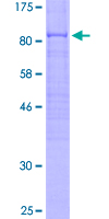 Cdc14 / CDC14A Protein - 12.5% SDS-PAGE of human CDC14A stained with Coomassie Blue