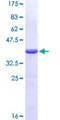 CDC14B Protein - 12.5% SDS-PAGE Stained with Coomassie Blue.