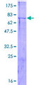 CDC20 Protein - 12.5% SDS-PAGE of human CDC20 stained with Coomassie Blue