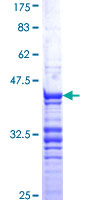 CDC20 Protein - 12.5% SDS-PAGE Stained with Coomassie Blue.