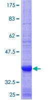 CDC20B Protein - 12.5% SDS-PAGE Stained with Coomassie Blue.