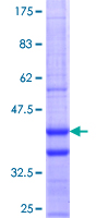 CDC23 Protein - 12.5% SDS-PAGE Stained with Coomassie Blue