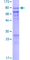 CDC25A Protein - 12.5% SDS-PAGE of human CDC25A stained with Coomassie Blue