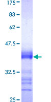 CDC25A Protein - 12.5% SDS-PAGE Stained with Coomassie Blue.