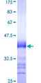 CDC25A Protein - 12.5% SDS-PAGE Stained with Coomassie Blue.