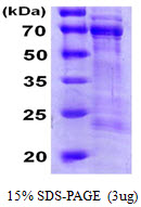 CDC25A Protein