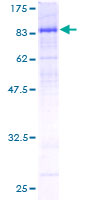 CDC25B Protein - 12.5% SDS-PAGE of human CDC25B stained with Coomassie Blue