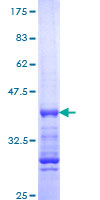 CDC25B Protein - 12.5% SDS-PAGE Stained with Coomassie Blue.