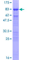 CDC25C Protein - 12.5% SDS-PAGE of human CDC25C stained with Coomassie Blue