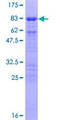 CDC25C Protein - 12.5% SDS-PAGE of human CDC25C stained with Coomassie Blue